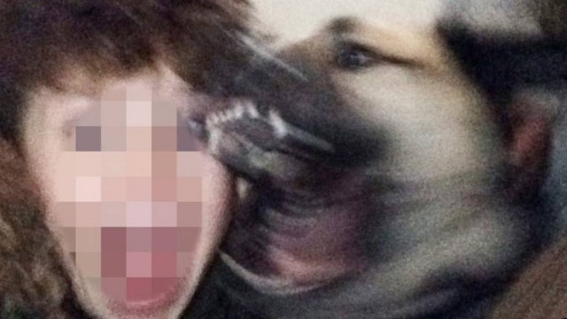 Menino leva 21 pontos no rosto ao ser atacado por cão enquanto tirava selfie