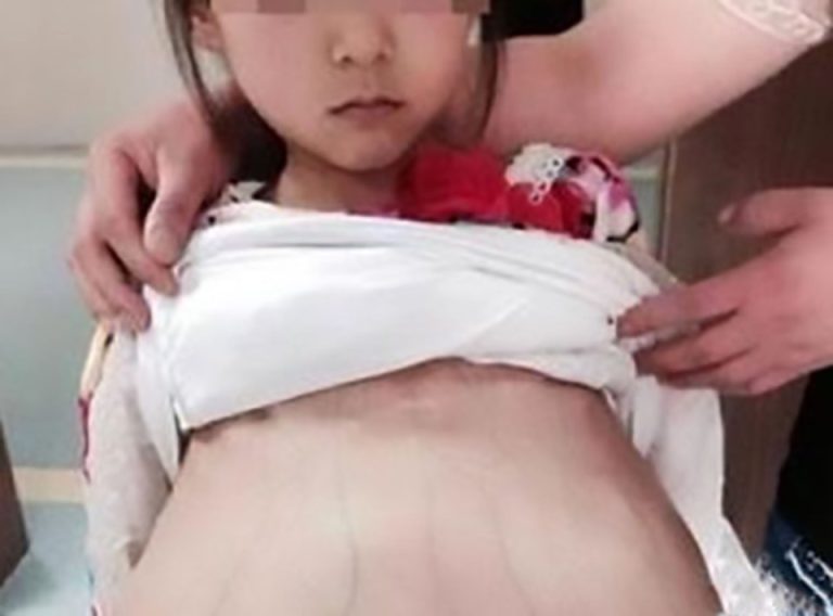 Menina de 12 anos, que estava grávida, foi levada ao hospital por marido de 40