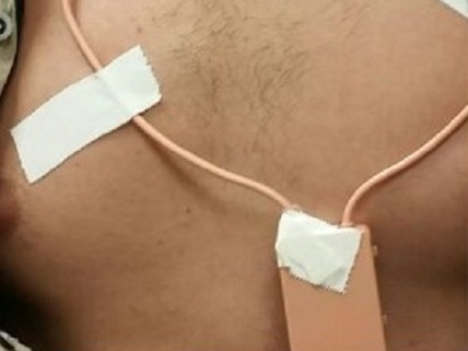 Homem é preso por usar ponto eletrônico no Enem