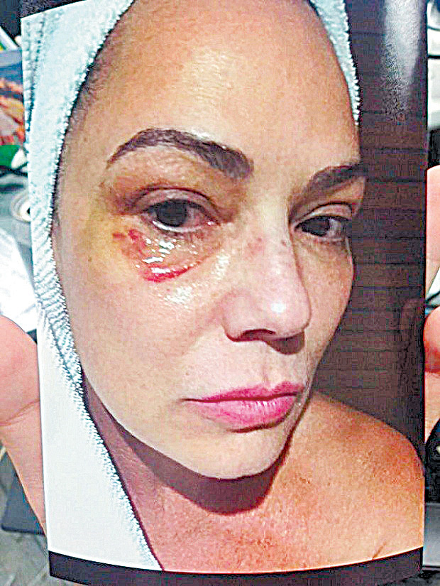 Ex de Luiza Brunet será julgado por agressão nesta terça-feira em São Paulo