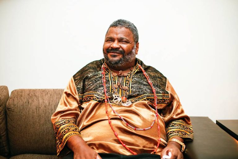 O cantor Arlindo teve o lado paralisado após o acidente vascular cerebral