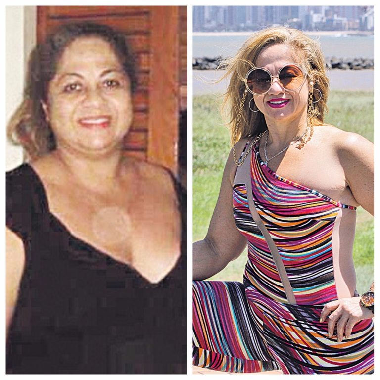 Professora perde 50 quilos sem fazer cirurgia
