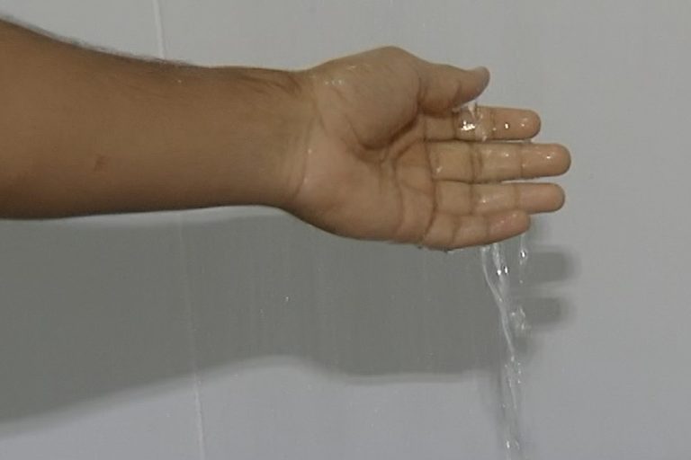 Há dois anos, jovem de 21 anos sofre com alergia a água