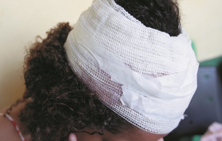 Marido agride mulher a pauladas e atinge bebê de seis meses no rosto