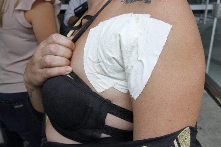 Manicure é esfaqueada após discussão por pedaço de frango