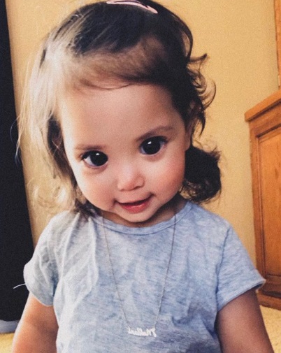 Síndrome rara faz menina de um ano ter “olhos de princesa”