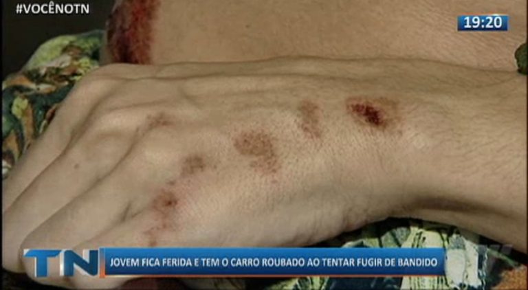 Jovem fica ferida e tem o carro roubado ao tentar fugir de bandido
