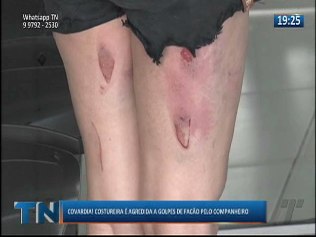 Costureira é agredida a golpes de facão pelo companheiro