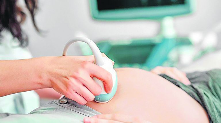Exame para verificar a saúde do bebê