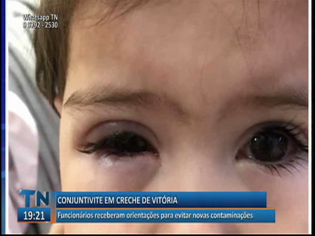 Funcionários receberam orientações para evitar novas contaminações de conjuntivite em creche