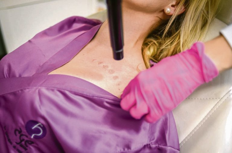 Cresce procura para remover tatuagens