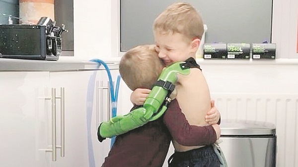Menino de 5 anos ganha prótese de braço e abraça irmão pela 1ª vez