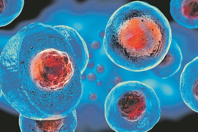 Segundo paciente com HIV é curado do vírus