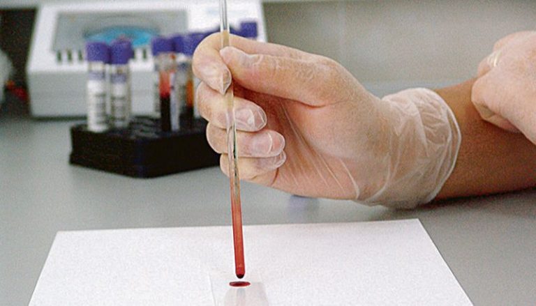 Cientistas do Estado fazem 35 pesquisas contra Covid-19