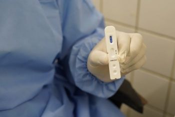 Cientistas confirmam 1º caso de reinfecção por coronavírus