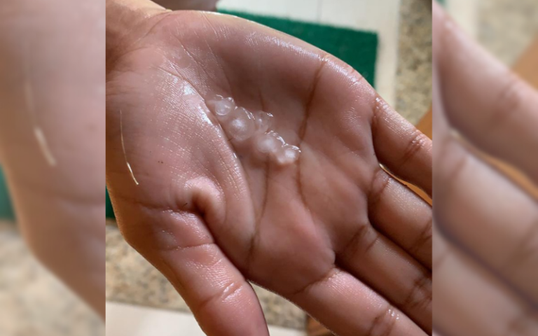 Moradores da Grande Vitória são surpreendidos com chuva de granizo
