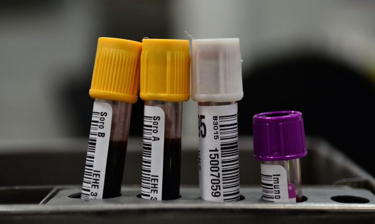 Brasil tem 371,6 mil mortes e 13,9 milhões de casos confirmados de Covid