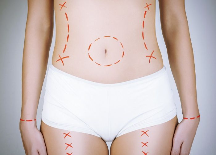 Supermodelo pede indenização de R$ 267 milhões por cirurgia que deu errado