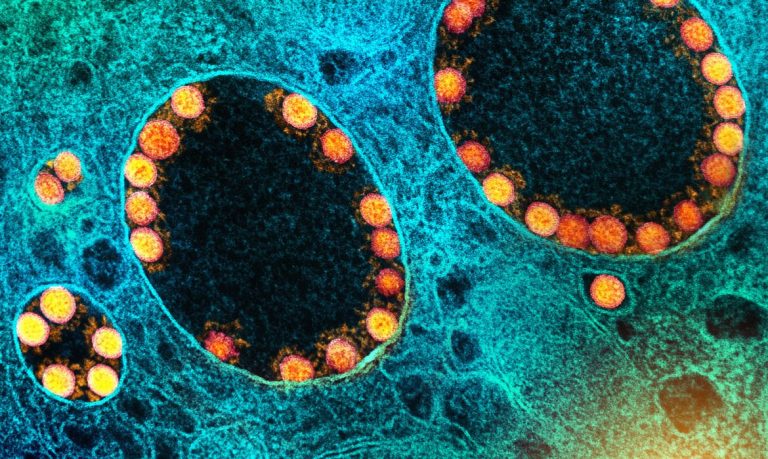 Variante Ômicron é detectada em 110 países