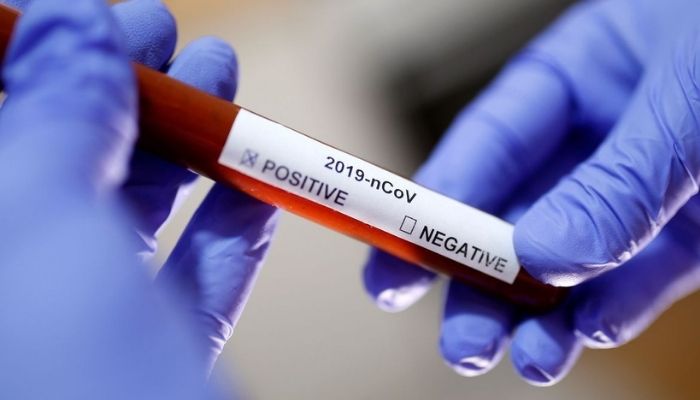 Brasil tem média de mortes por Covid abaixo de 100 pela 1ª vez desde janeiro