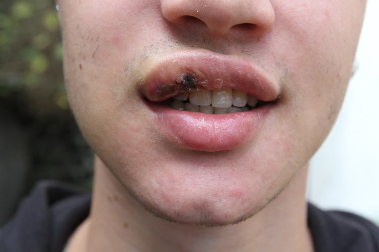 Professor é agredido por aluno em escola e denuncia homofobia