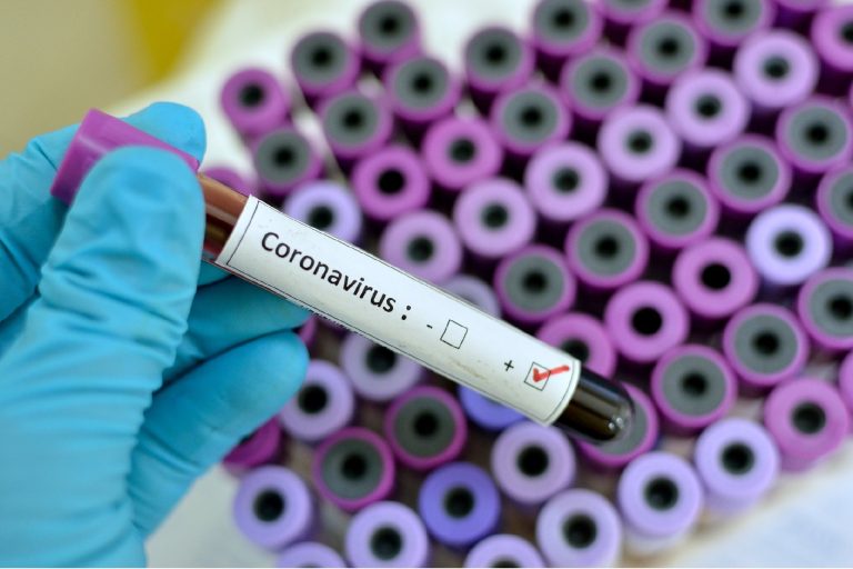 Brasil registra 57,9 mil novos casos e 353 óbitos por covid-19
