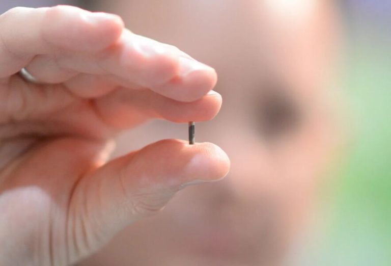 Consumidor faz implante de chip para pagar compra sem cartão ou celular