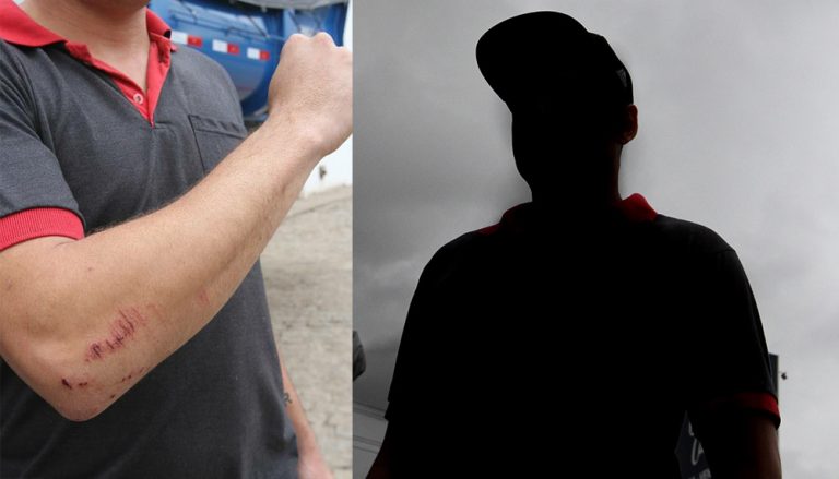 “Não dá nem para entender”, diz agredido por policial durante festa em Viana