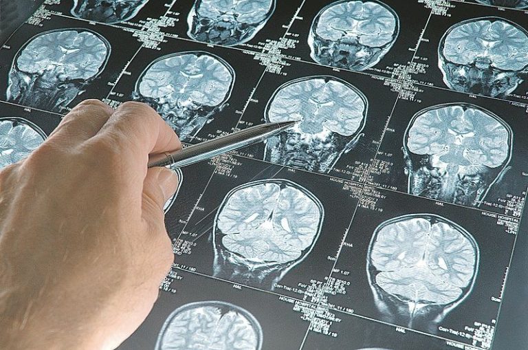 Dia Mundial do Alzheimer alerta para aumento de casos no mundo
