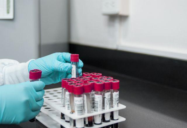Ministério da Saúde confirma 111 casos de hepatite desconhecida no País