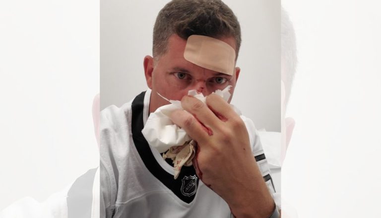 Torcedor quebra o nariz após ser atingido por disco em partida de hóquei