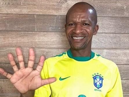 Baiano de seis dedos já se considera hexa e ficou “aliviado” com 7 a 1