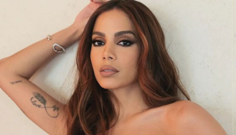 Anitta tenta separar briga e leva mordida de cachorros: “Feliz 2023”