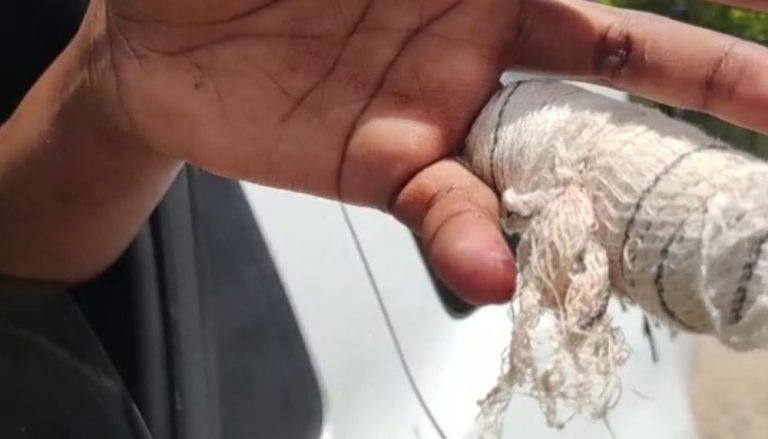 Jovem tem cabelo cortado e dedo decepado em Vitória