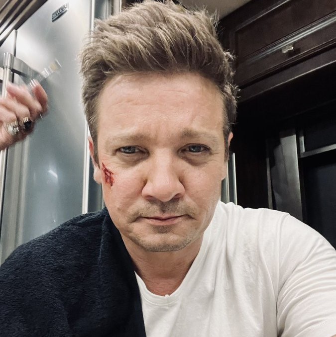 Jeremy Renner recebe alta após acidente grave