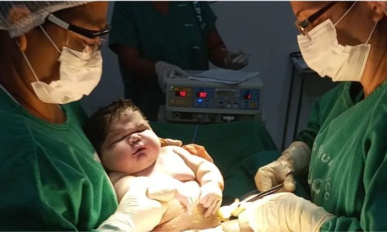 Bebê gigante nascido com mais de 7 quilos é o maior do Amazonas