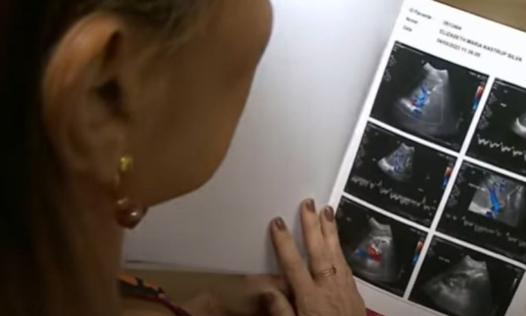 Mãe recebe parte do fígado da filha em transplante inédito no Brasil