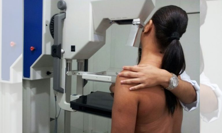 Mudança em mamografia nos EUA altera regras no Brasil?