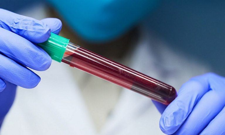 Exame promete identificar mais de 50 tipos de câncer