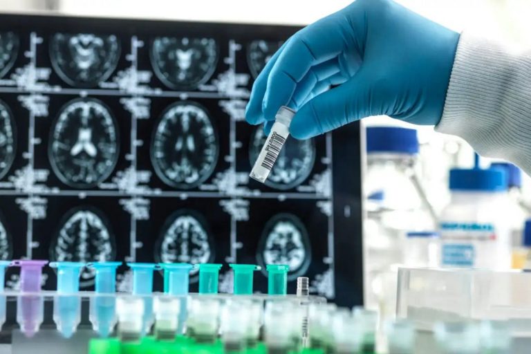 Nova droga contra Alzheimer deve demorar a chegar ao Brasil