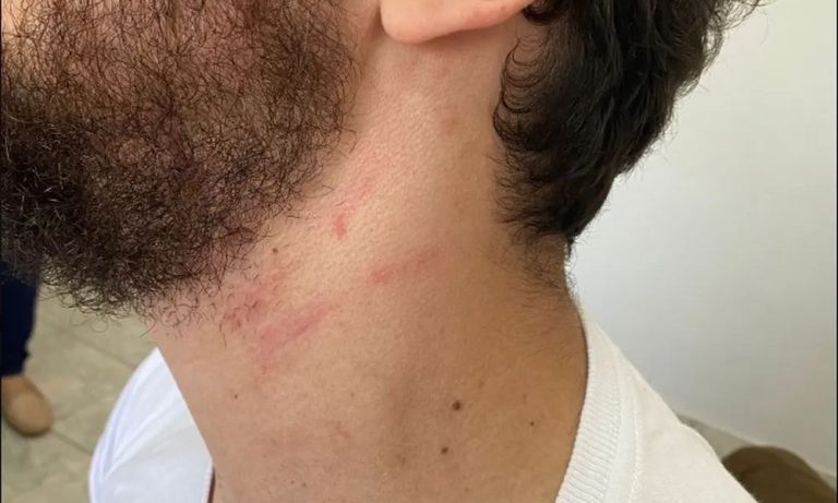 PF investiga delegado que agrediu professor do filho em escola