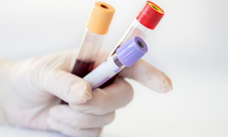 Exame de sangue para diagnóstico de Alzheimer chega ao Brasil