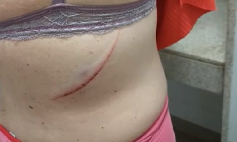 Mulher é agredida pelo marido com golpe de caratê no ES