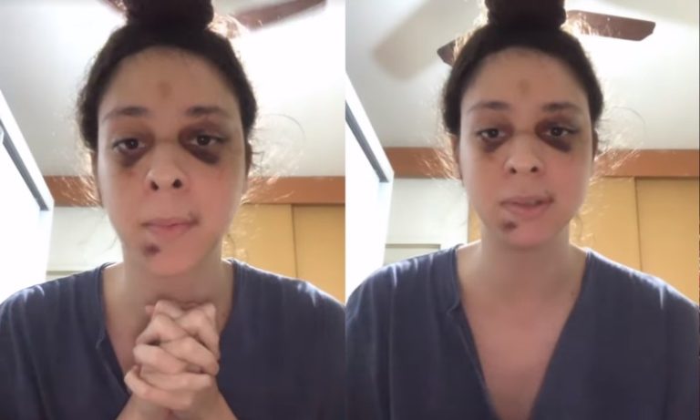 Victor Meyniel agradece apoio em vídeo após ter sofrido agressão
