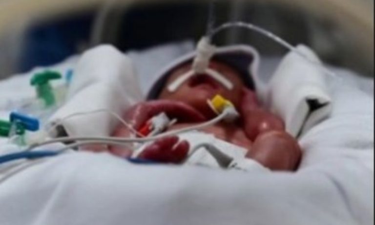 Mãe dos sêxtuplos atualiza estado de saúde dos filhos e posta imagens dos bebês