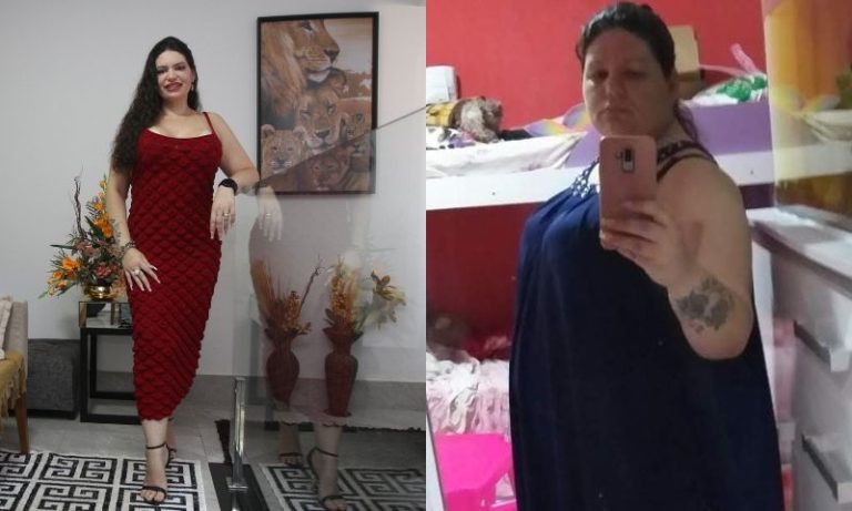 Pacientes mostram “antes e depois” após cirurgias e procedimentos estéticos
