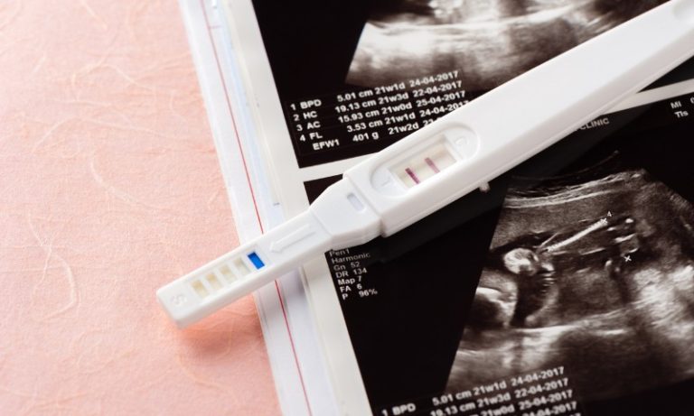 Seis em cada 10 mulheres já tiveram uma gravidez não planejada