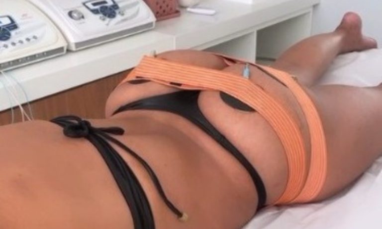 Tendência agora é fazer harmonização no bumbum
