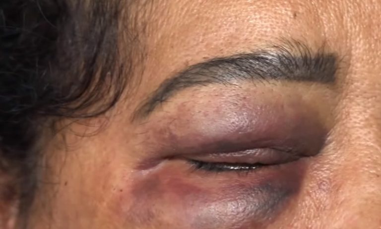 Manicure é agredida pelo ex-marido após se recusar a cozinhar