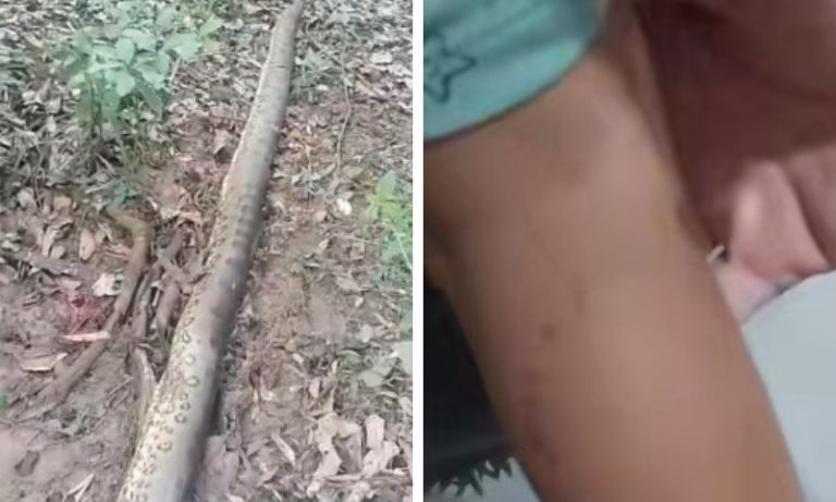 Menino de 2 anos é atacado por sucuri de 6 metros